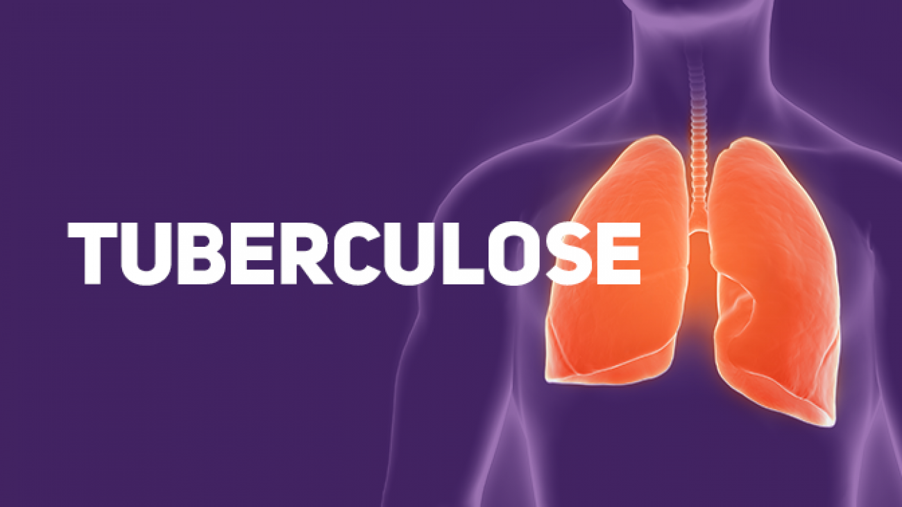 Tuberculose