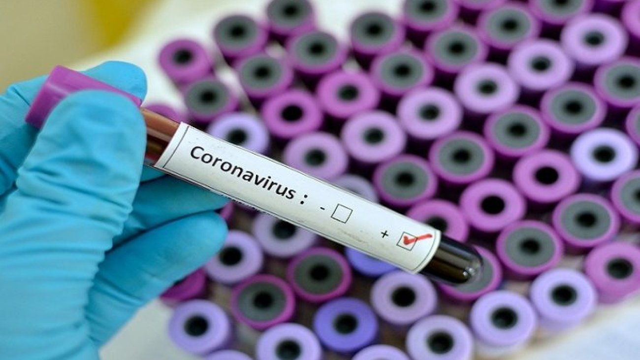 coronavirus-teste-1-730x425