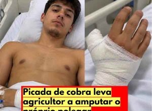 picada-de-cobra-agricultor-minas-gerais