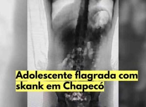skank-presidio-chapeco-sc